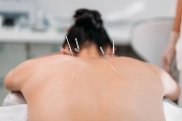 Partial view of woman with needles on back having acupuncture therapy in spa salon — Stock Photo