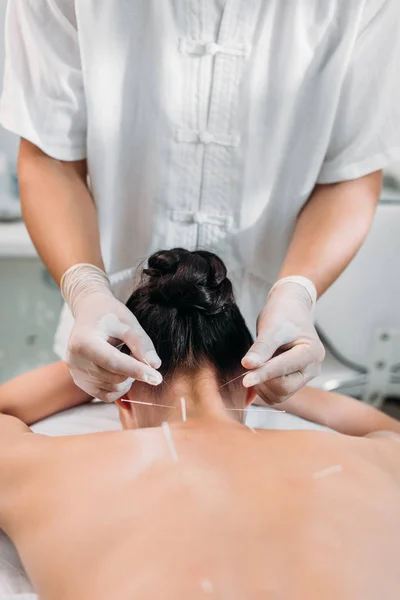 Inyección recortada de cosmetólogo poner agujas en el cuerpo de las mujeres durante la terapia de acupuntura en el salón de spa - foto de stock
