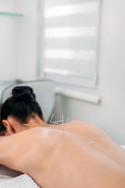 Partial view of woman with needles on body having acupuncture therapy in spa salon — Stock Photo