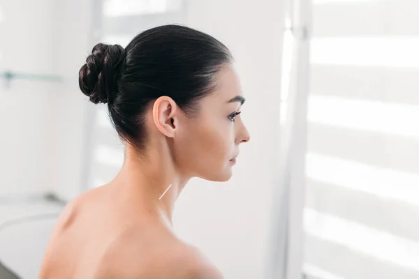 Side view of beautiful woman having acupuncture therapy in spa salon — Stock Photo