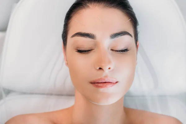 Vue aérienne de la femme relaxante tout en ayant une thérapie d'acupuncture dans le salon de spa — Photo de stock