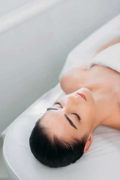 Woman with needles on face having acupuncture therapy in spa salon — Stock Photo