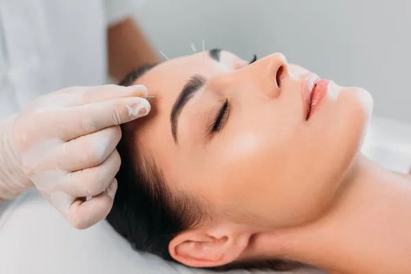 Partial view of cosmetologist putting needles on womans forehead during acupuncture therapy in spa salon — Stock Photo