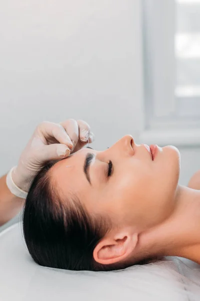 Vista parcial del cosmetólogo colocando aguja en la frente de las mujeres durante la terapia de acupuntura en el salón de spa - foto de stock