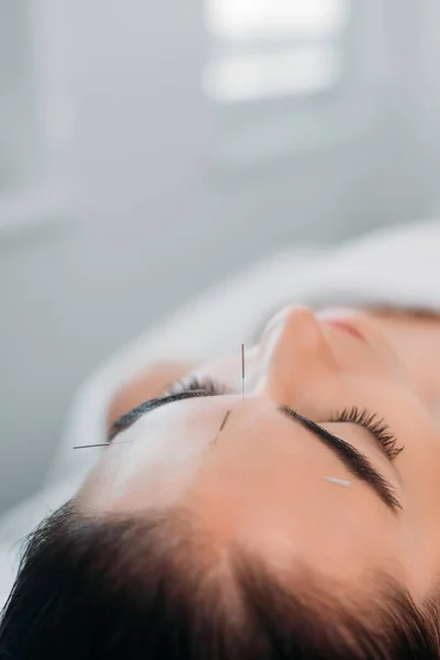 Frau mit Nadeln im Gesicht bei Akupunkturtherapie im Wellness-Salon — Stockfoto