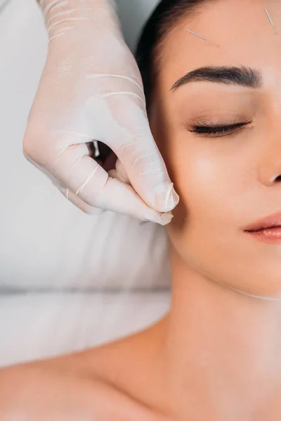 Teilansicht des Kosmetikers, der bei der Akupunkturtherapie im Wellness-Salon Nadeln auf die Stirn der Frau setzt — Stockfoto