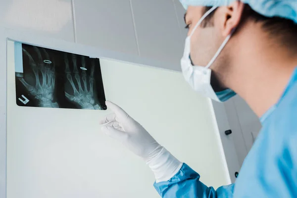 Selective focus of doctor pointing with finger at x-ray in clinic — Stock Photo