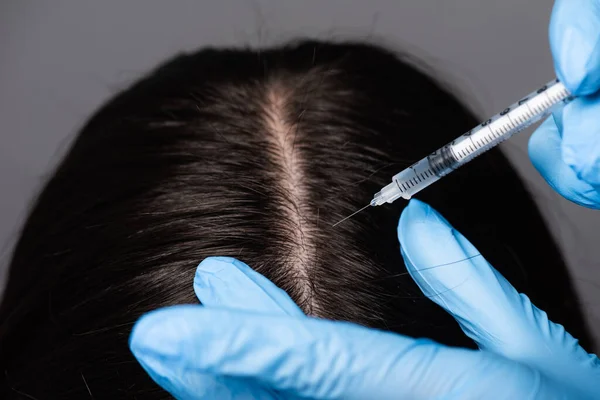 Vista de cerca de la mujer morena que tiene mesoterapia cuero cabelludo aislado en negro - foto de stock