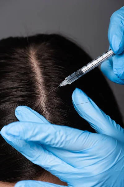 Vista de perto da mulher morena ter mesoterapia couro cabeludo isolado em preto — Fotografia de Stock