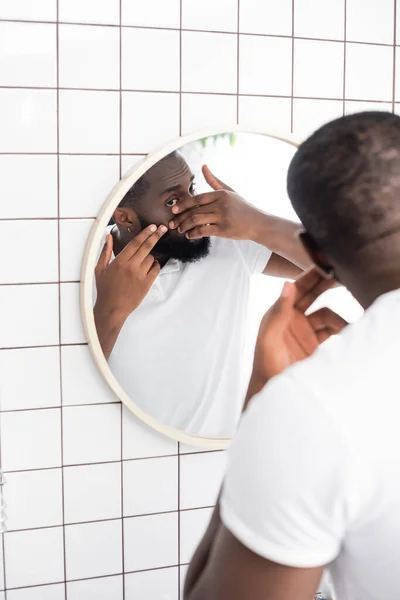 Hombre afro-americano tratando de apretar espinilla - foto de stock