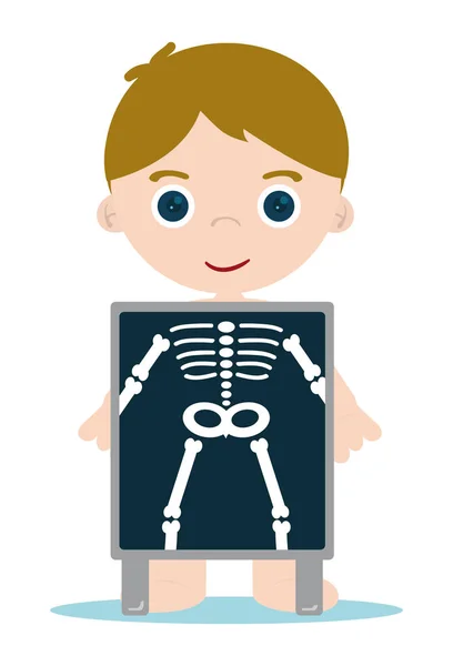 Huesos de rayos X niño — Vector de stock