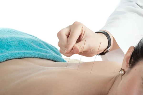 Jonge vrouw op acupunctuur behandeling — Stockfoto