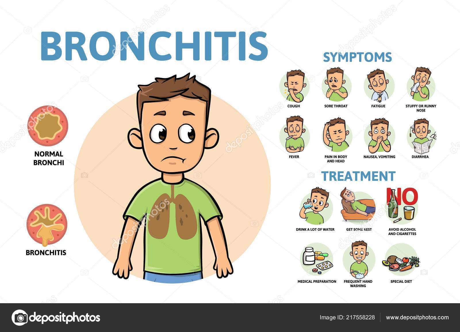 Bronquitis causas sintomas e tratamento