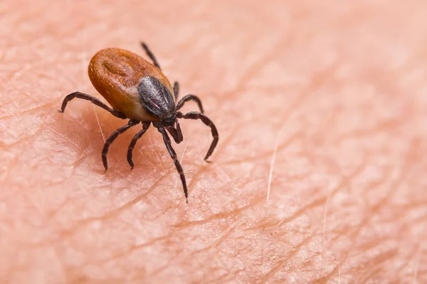 Carrapato de veado fêmea infectado na pele humana peluda. Ixodes ricinus. Ácaro parasita. Acarus — Fotografia de Stock