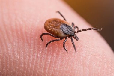 İnsan parmağının derisinde dişi geyik kenesi. Ixodes ricinus veya skapularis. Parmak ucunda sürtünme sırtları olan, dinamik hareketli tehlikeli parazit akarların yakın çekimi. Ensefalit olarak bulaşan hastalıklar.