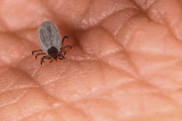 Biting castor bean tick with hypostom penetrating a skin and outstretched palps. Ixodes ricinus. Small female parasitic mite when piercing human epidermis. Fattened parasite body. Tick-borne diseases.