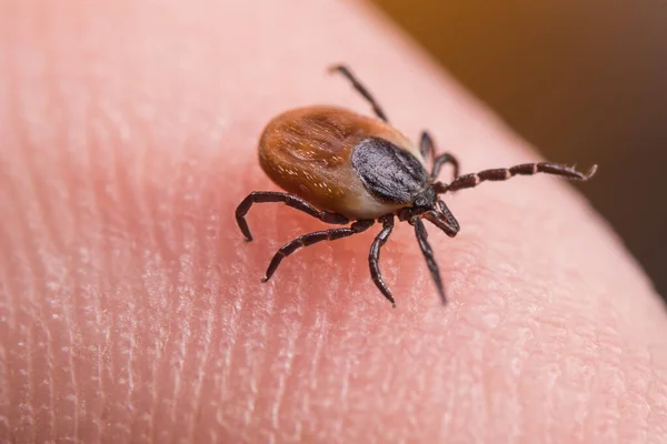 İnsan parmağının derisinde dişi geyik kenesi. Ixodes ricinus veya skapularis. Parmak ucunda sürtünme sırtları olan, dinamik hareketli tehlikeli parazit akarların yakın çekimi. Ensefalit olarak bulaşan hastalıklar.