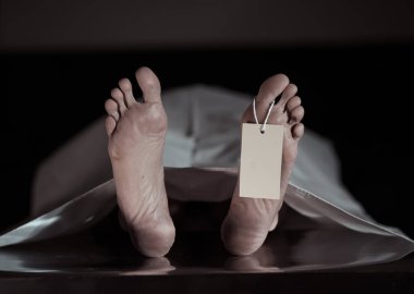 Close-up of dead body feet at morgue or hospital with toe label or information ring and identification blank tag. Cadaver lying on steal table covered with sheet on autopsy table. Death concept. clipart