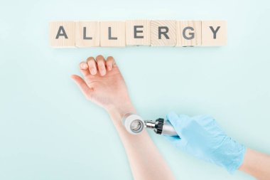 mavi izole kelime alerjisi ile ahşap bloklar yakınında dermatoskop ile kadının elini inceleyen doktor kırpılmış görünümü