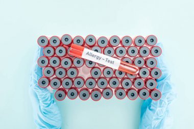 mavi üzerinde diğer tüpler üzerinde örnek ile test tüpleri tutan lateks eldiven doktor kırpılmış görünümü