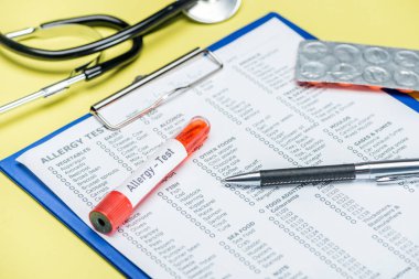 sarı üzerinde stetoskop yakın alerji testi sonuçları test tüpü ve kalem
