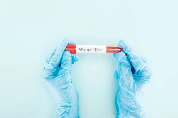 Cropped View Doctor Latex Gloves Holding Test Tube Sample Allergy — Stock Photo, Image
