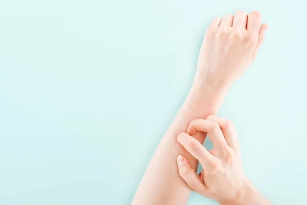 Wykadrowany Widok Kobiety Swędzenie Dłoni Izolowane Niebiesko Koncepcja Alergii — Zdjęcie stockowe