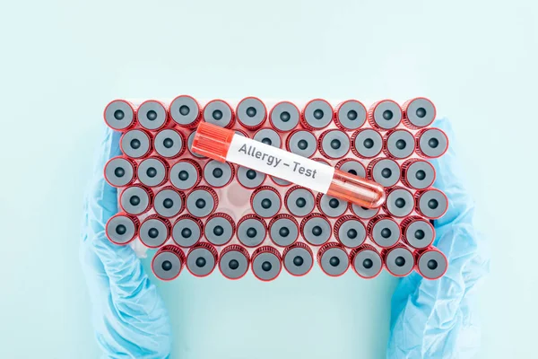 Cropped View Doctor Latex Gloves Holding Test Tubes Sample Other — Stock Photo, Image