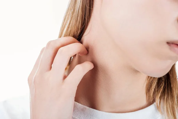 Cropped View Woman Itching Neck Hand Isolated White — Stock Photo, Image