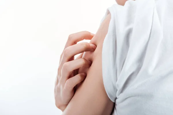 Cropped View Woman Itching Shoulder Isolated White — Stock Photo, Image