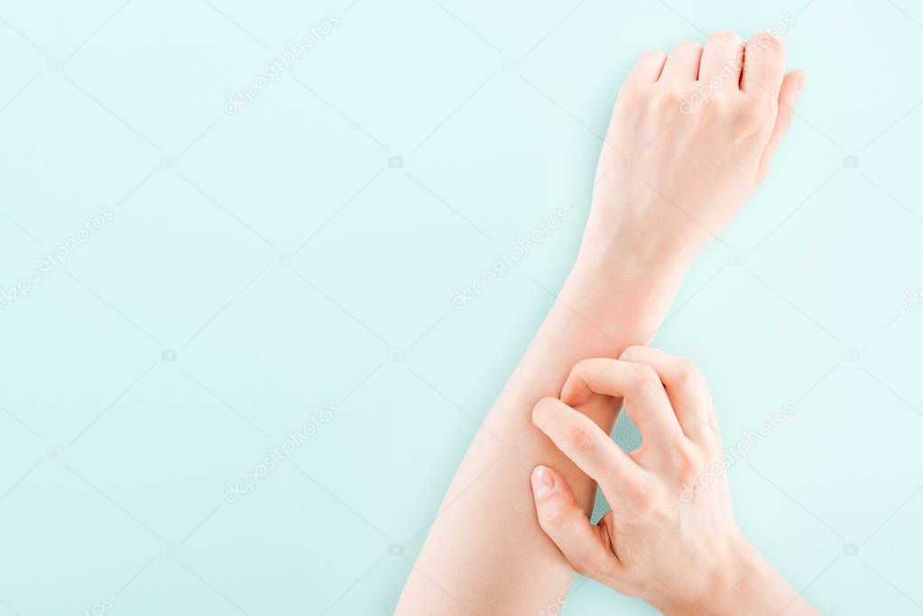 cropped view of woman itching hand isolated on blue, allergy concept