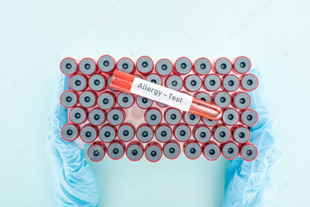 cropped view of doctor in latex gloves holding test tubes with sample above other tubes on blue