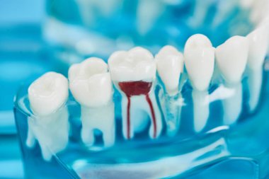 beyaz dişler ve kırmızı diş kökü ile diş modeli seçici odak 