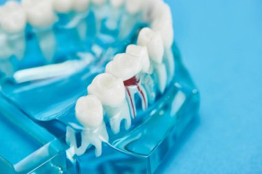 mavi izole kırmızı diş kökü ile diş modeli seçici odak 