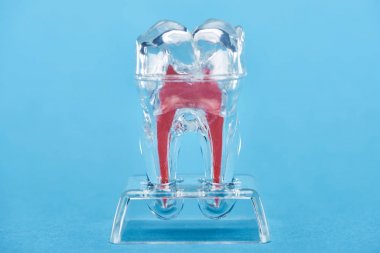 silicone tooth model with red dental root isolated on blue  clipart