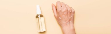panoramic shot of female hand with dry, exfoliated skin near antiseptic spray on beige clipart