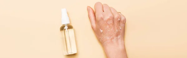 Panoramic Shot Female Hand Dry Exfoliated Skin Antiseptic Spray Beige — Stock Photo, Image