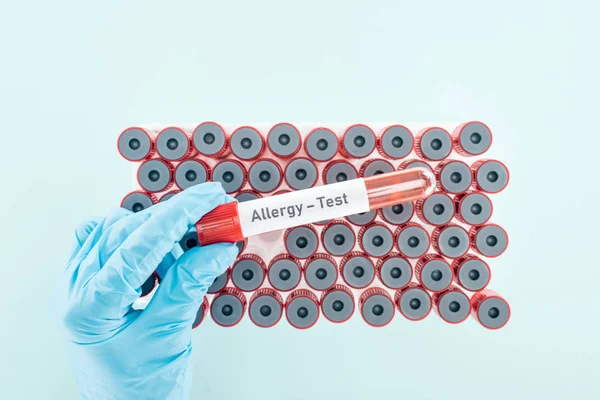 Vista recortada del médico que sostiene la muestra con letras de prueba de alergia por encima de los tubos de ensayo aislados en azul - foto de stock