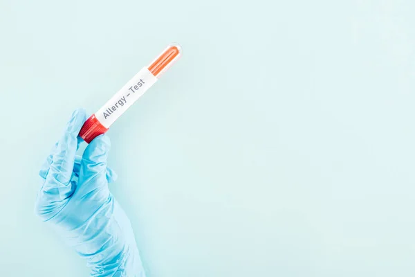 Cropped view of doctor holding sample in test tube with allergy test inscription isolated on blue — Stock Photo