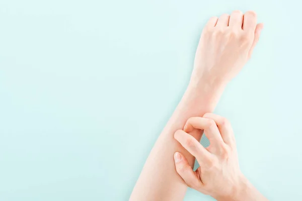 Cropped view of woman itching hand isolated on blue, allergy concept — Stock Photo