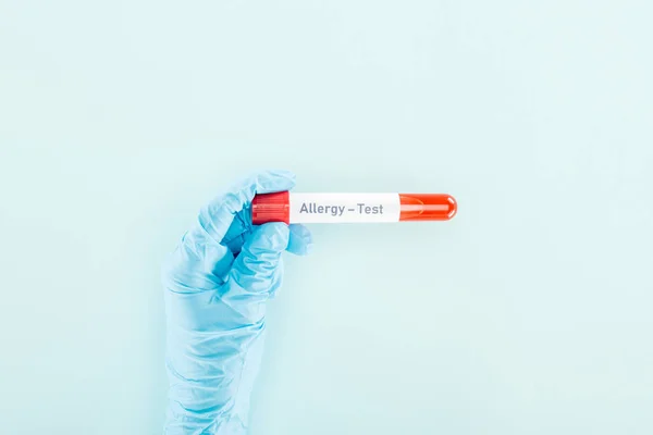 Vista ritagliata del medico in guanto di lattice campione di tenuta con iscrizione di prova di allergia isolato su blu — Foto stock
