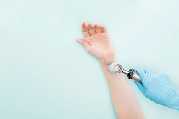 Vista ritagliata del medico esaminando mano della donna con dermatoscopio isolato su blu — Foto stock