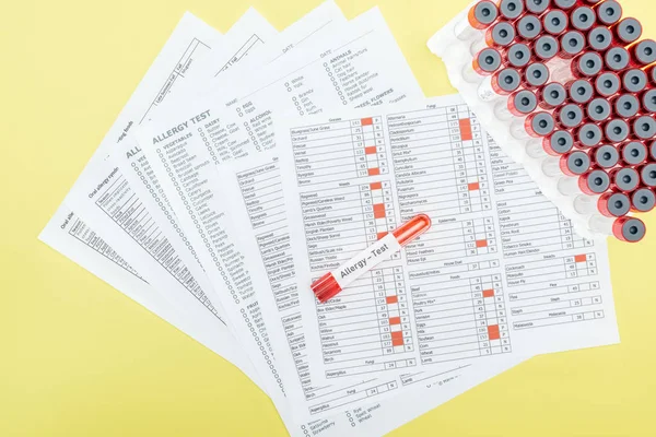 Visão superior dos resultados dos testes de alergia perto dos tubos de ensaio com letras de teste de alergia isoladas em amarelo — Fotografia de Stock
