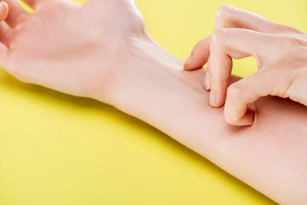 Abgeschnittene Ansicht der juckenden Hand einer Frau auf gelbem Hintergrund — Stockfoto