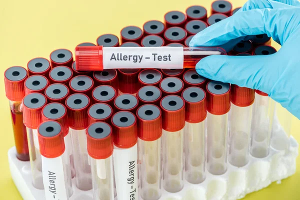 Cropped view of doctor holding sample with allergy test inscription above empty test tubes isolated on yellow — Stock Photo