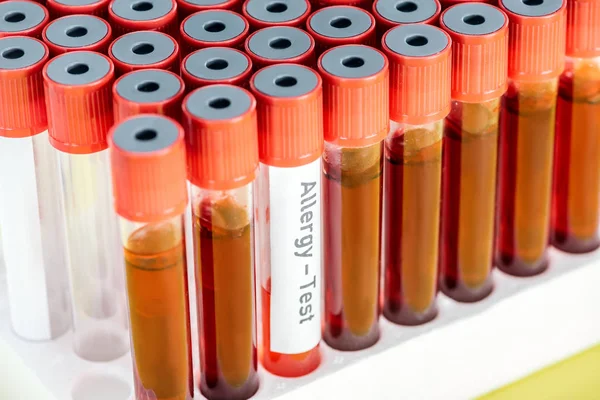 Visão de perto das amostras em tubos de ensaio e um tubo com inscrição de teste de alergia isolado em amarelo — Fotografia de Stock