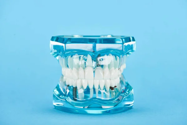 Foco seletivo do modelo de dentes com dentes brancos isolados em azul — Fotografia de Stock