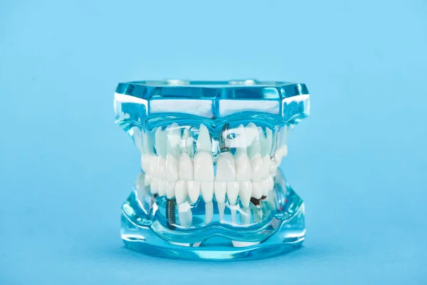 Selective focus of teeth model with white teeth isolated on blue — Stock Photo