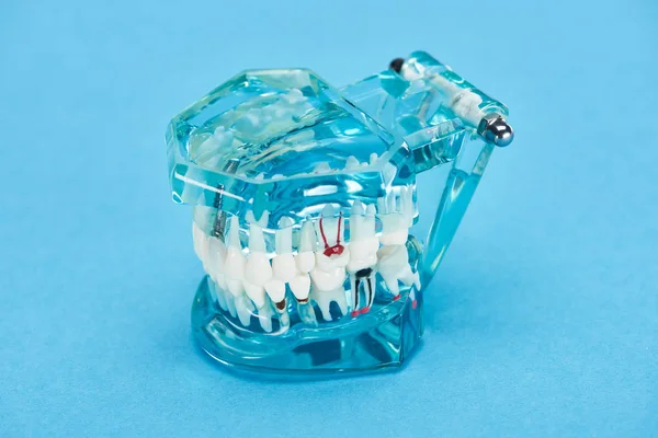 Modelo de dientes con raíces dentales rojas en dientes blancos sobre azul - foto de stock