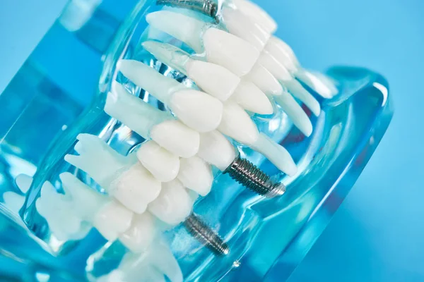 Селективный фокус модели зубов с белыми зубами на синем — стоковое фото